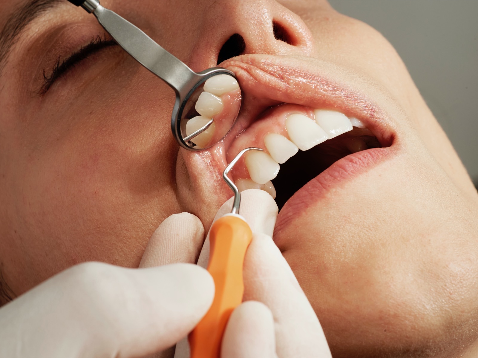 Klinikte profesyonel diş taşı temizliği uygulaması